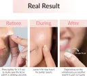 Priveda Spot Clearing Patch (Pouch) 100% Made in Korea Pimple/Acne absorbing (57 g)