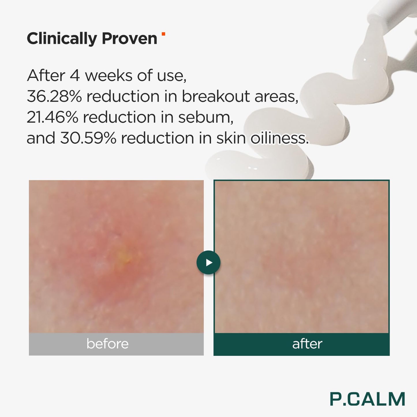 P.Calm Centella Trouble Spot 15ml